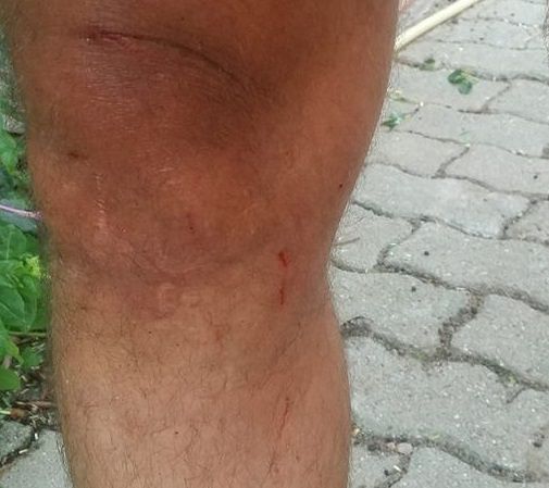 Daniele Caruso: “Aggredito da tre cani arrabbiati a Flumini”