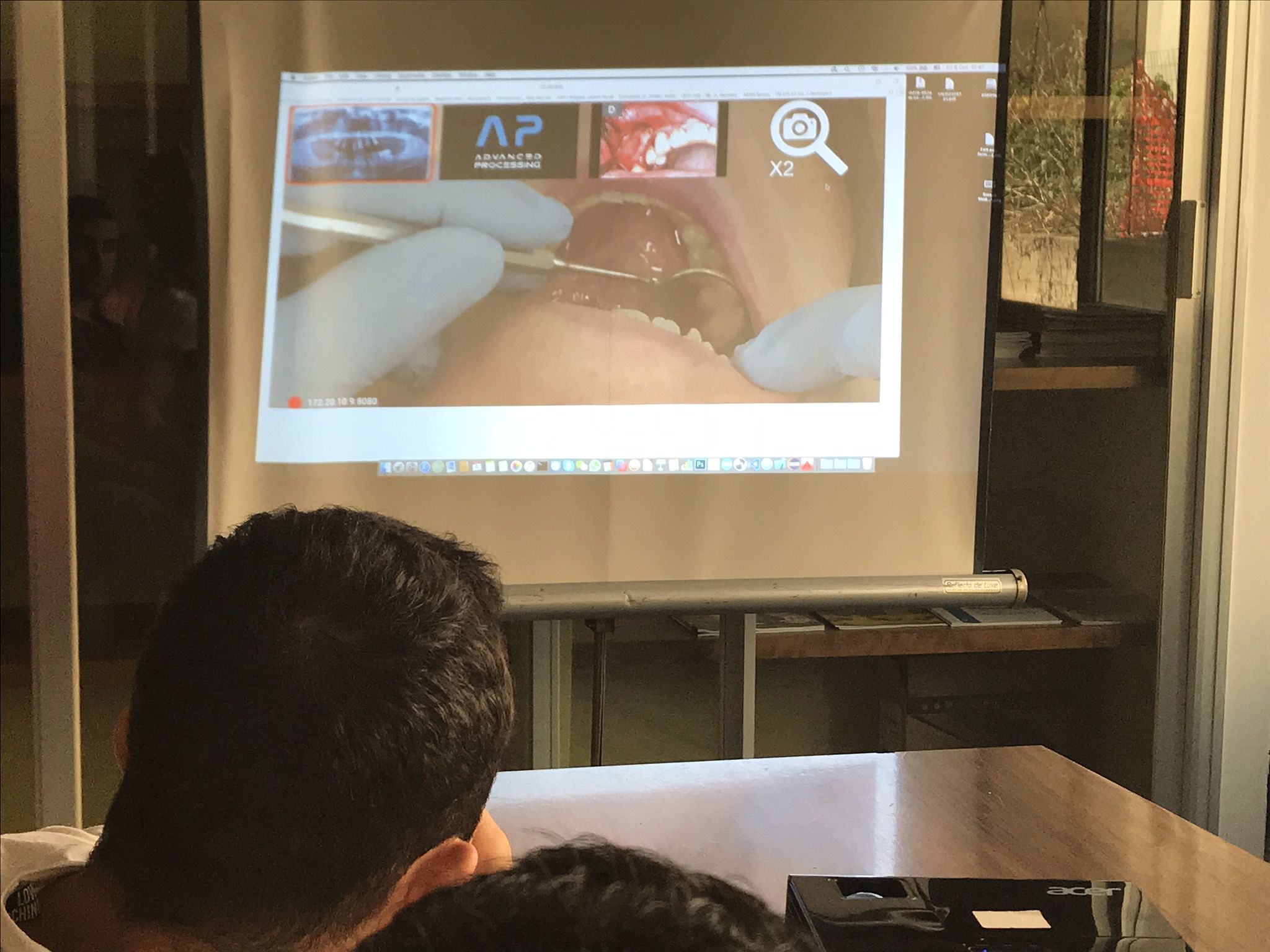 Horus, il visore per la realtà aumentata entra in sala operatoria a Cagliari