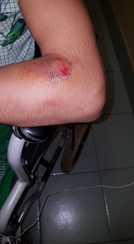 “Mio figlio investito da un’auto pirata in via Vesalio, cerco testimoni”