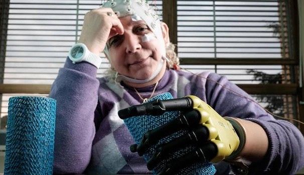 Prima mano bionica al mondo, il “cuore” del progetto realizzato a Cagliari