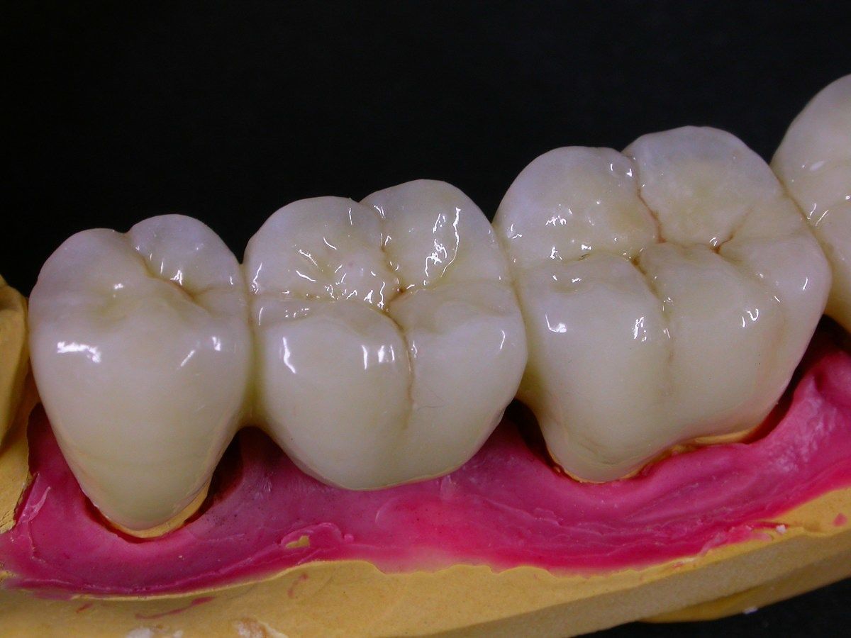 Lesioni a un paziente con protesi, condannato odontoiatra di Capoterra