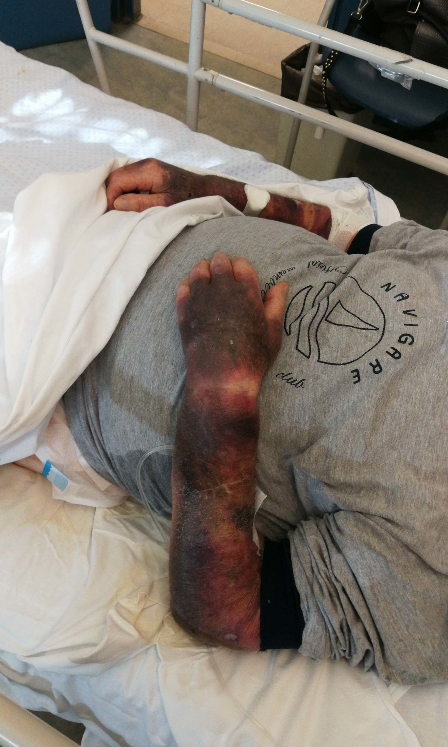 “Mio padre abbandonato al Brotzu sporco per ore: gli è stata rubata anche la fede”