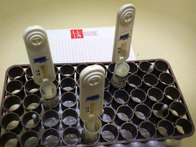 Hiv, domani a Cagliari si può fare il test rapido salivare