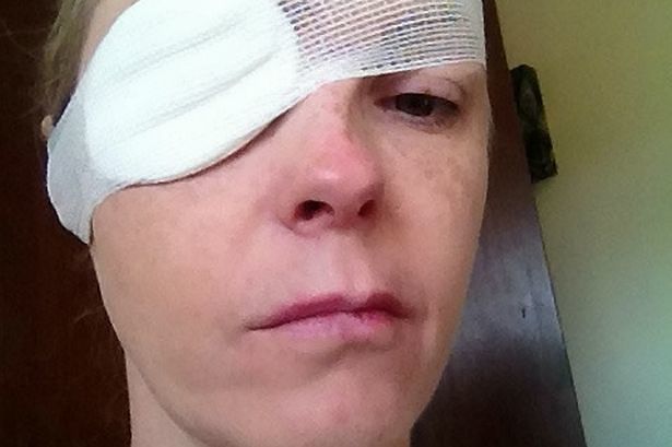 Mamma completamente sfigurata dalla puntura di una zecca contrae una grave malattia