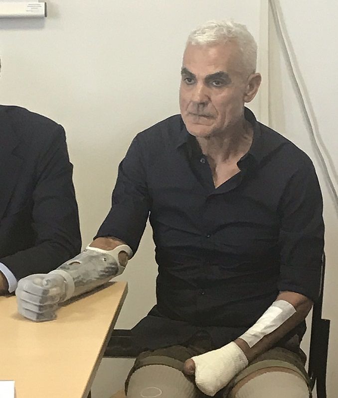 Il miracolo di “Massiccione”, Zanda è di nuovo in piedi: “Correrò con i miei arti bionici”