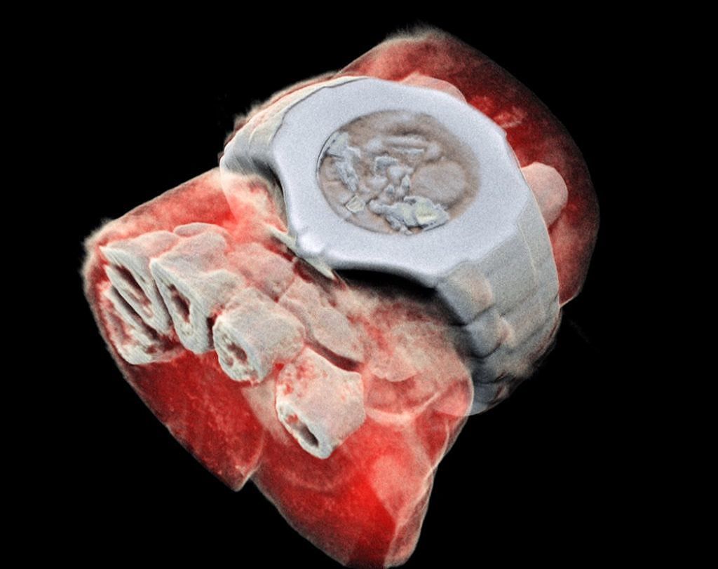 Prima radiografia 3D a colori di un essere umano: rivoluzione nella diagnosi