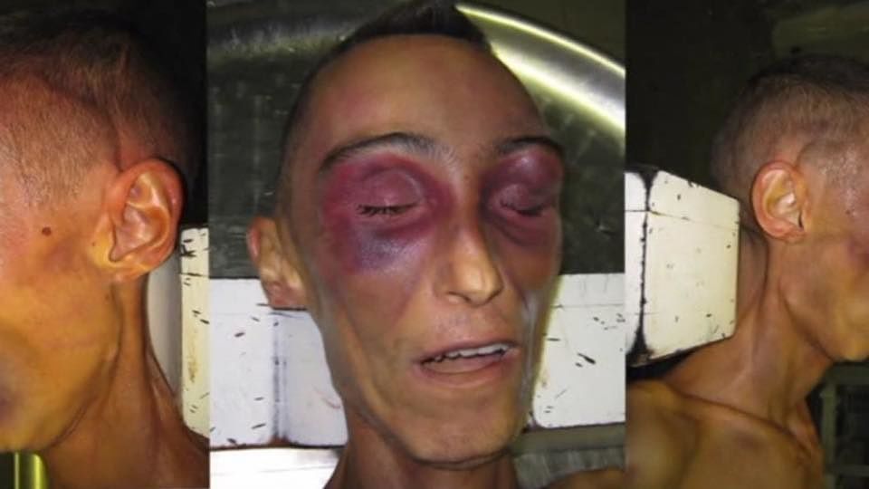 Caso Cucchi, la svolta. Carabiniere imputato ammette: “C’è stato un pestaggio”