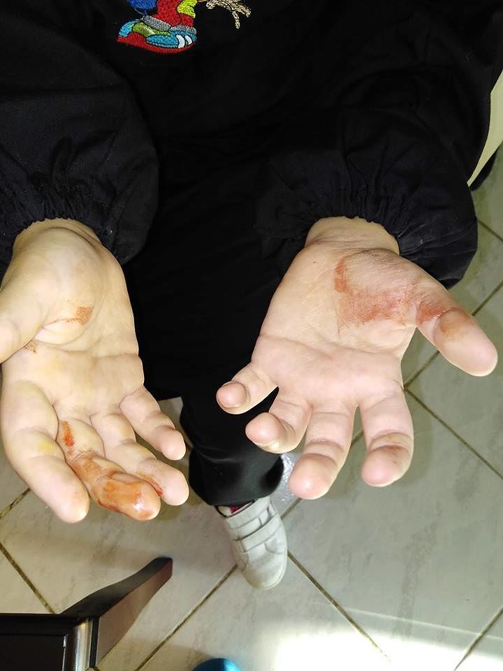 Carbonia, bimbo inciampa nel marciapiede disastrato e finisce in ospedale: la delusione della mamma