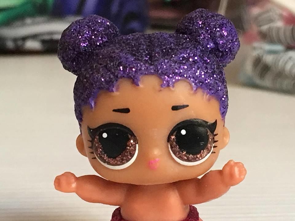 Le cornee della piccola Amelia di Cagliari a una bimba e un ragazzo, papà Corrado: “Piango di gioia”