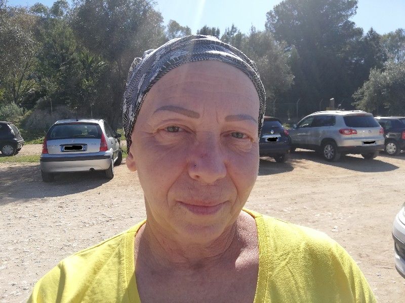 Germana di Cagliari, guerriera contro l’endometriosi: “Non lavoro e a 49 anni sopravvivo senza nessun aiuto”