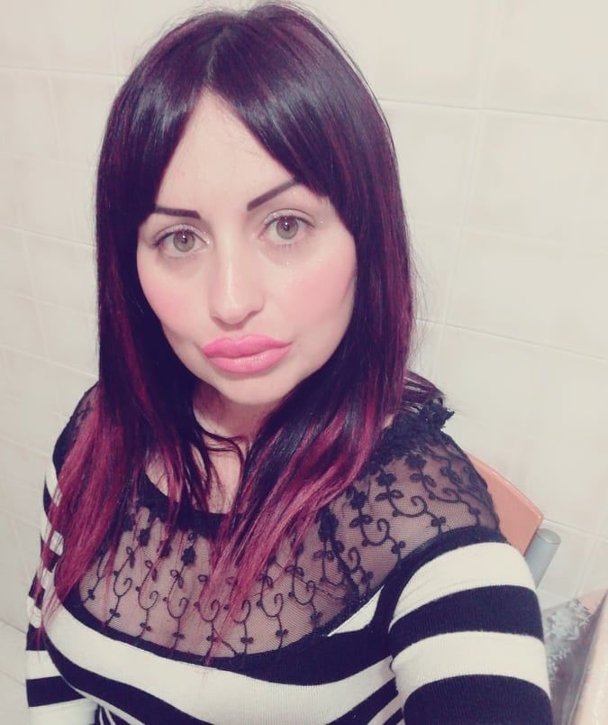 Claudia di Cagliari, distrutta dall’endometriosi ma salvata dall’amore: “Quello di mio figlio e mio marito”