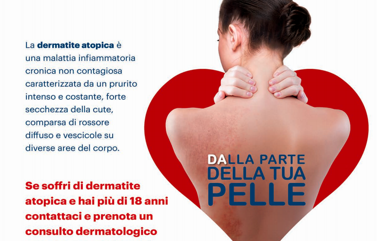 Cagliari, visite gratuite per dermatite atopica al San Giovanni di Dio