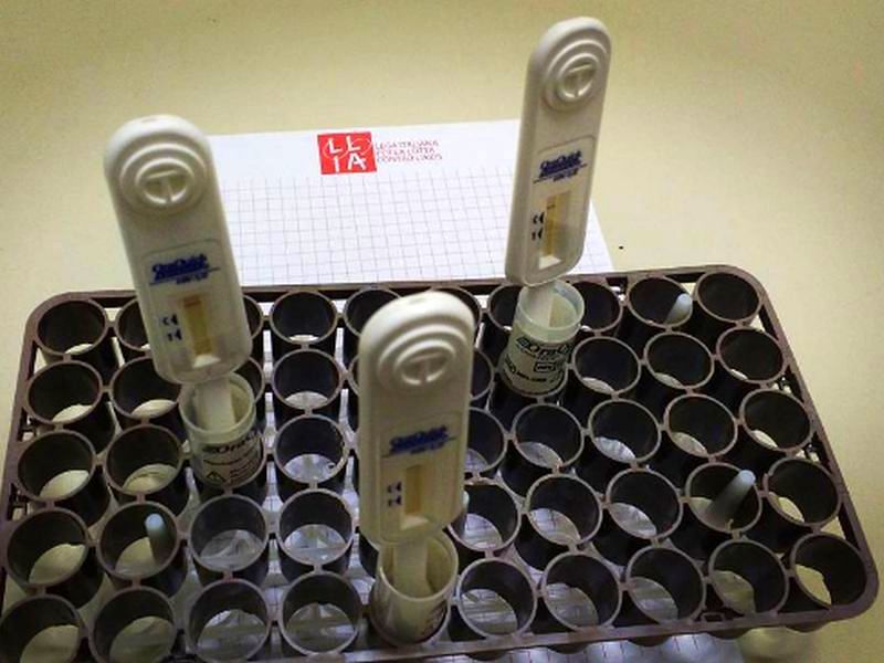 Cagliari, test rapido per l’Hiv per tutti i giovani: ecco quando sarà possibile