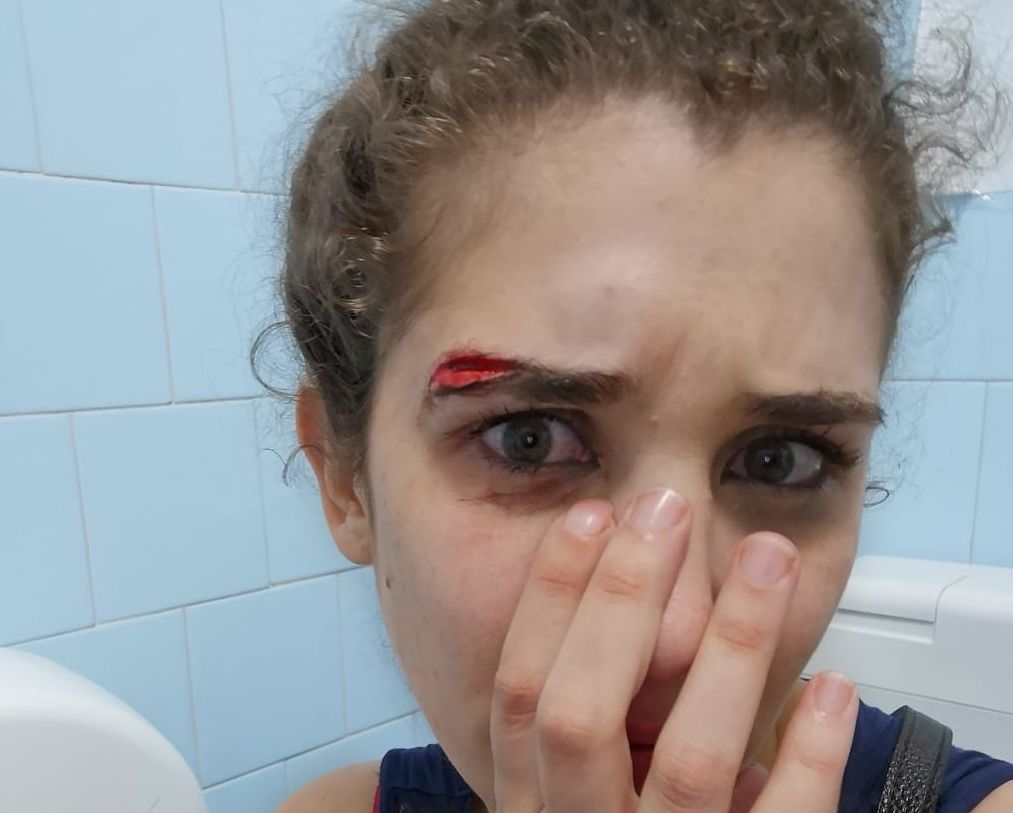 Cagliari, insultata e picchiata dopo il party universitario: “Chiusa dentro casa 5 giorni per lo choc”