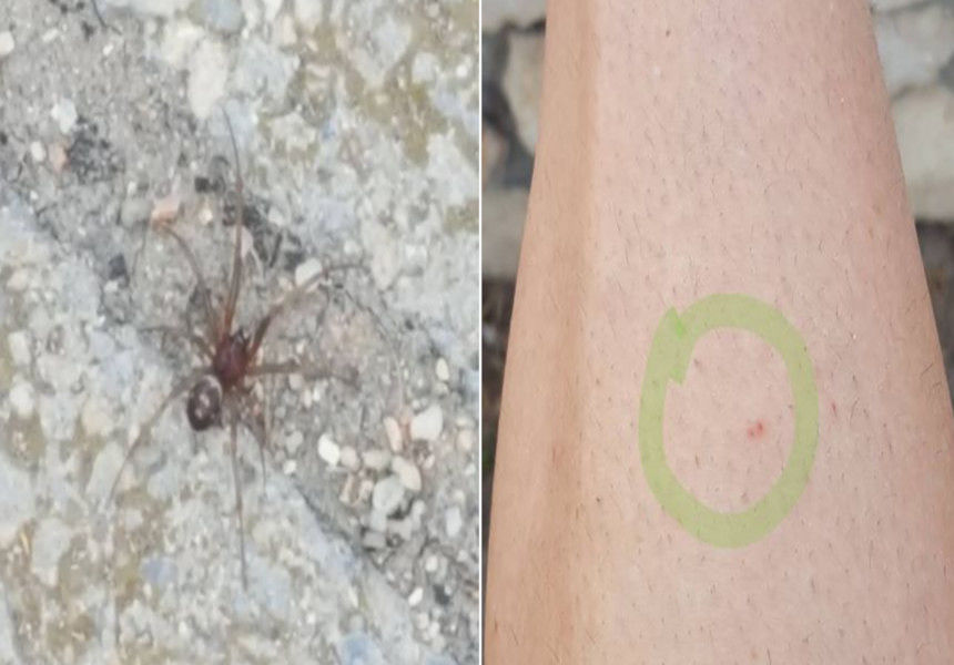 Disavventura per un 39enne al Poetto di Quartu: “Morso da un ragno velenoso, combatto tra febbre e nausea”