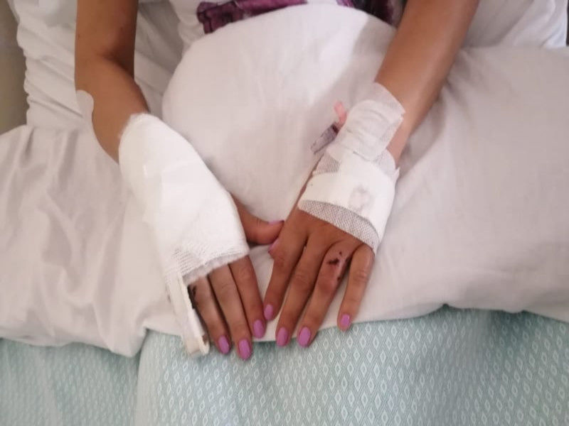 Choc a Decimoputzu: “Aggredita e ferita a morsi da un pastore tedesco di 50 chili, potevo morire”