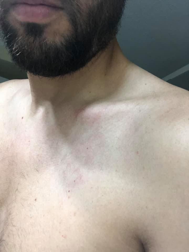 Cagliari, giovane aggredito al Poetto: “Ti fai un selfie? Volevano aggredirmi in dieci per rubare”