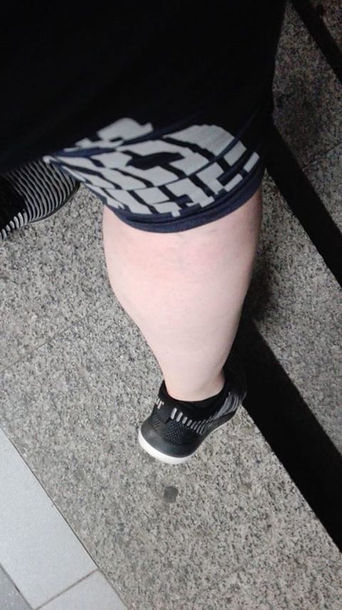 “Io, in ospedale a Cagliari, con la gamba gonfissima: buttata 11 ore pagando un ticket di 25 euro…”