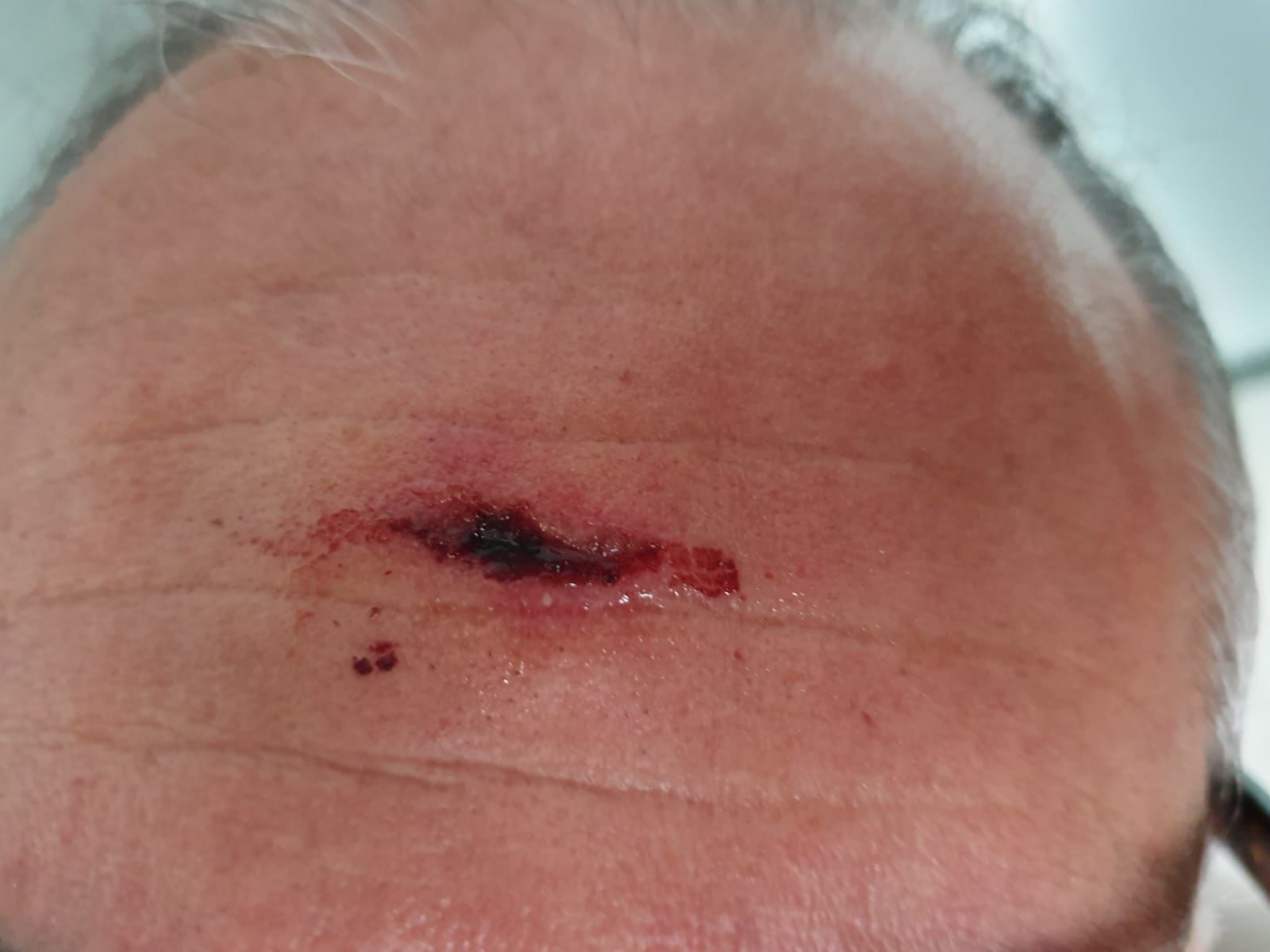 “Mio cognato ferito alla testa e dimenticato dai medici dell’ospedale Civile di Sassari per 5 ore”