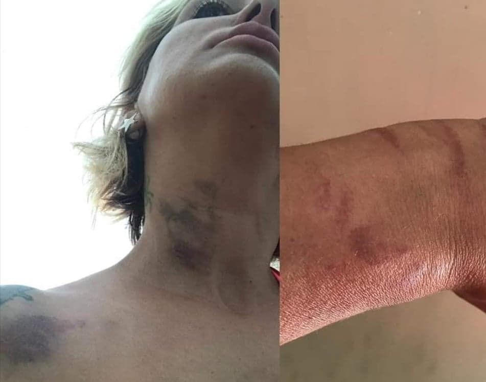 Cagliari, il racconto choc di Tiziana Troja: “Punta da una medusa gigante, potevo morire”