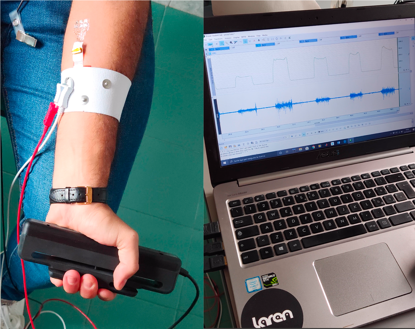 Pelle artificiale, passi da gigante dai ricercatori dell’ateneo di Cagliari intervistati su Rai3