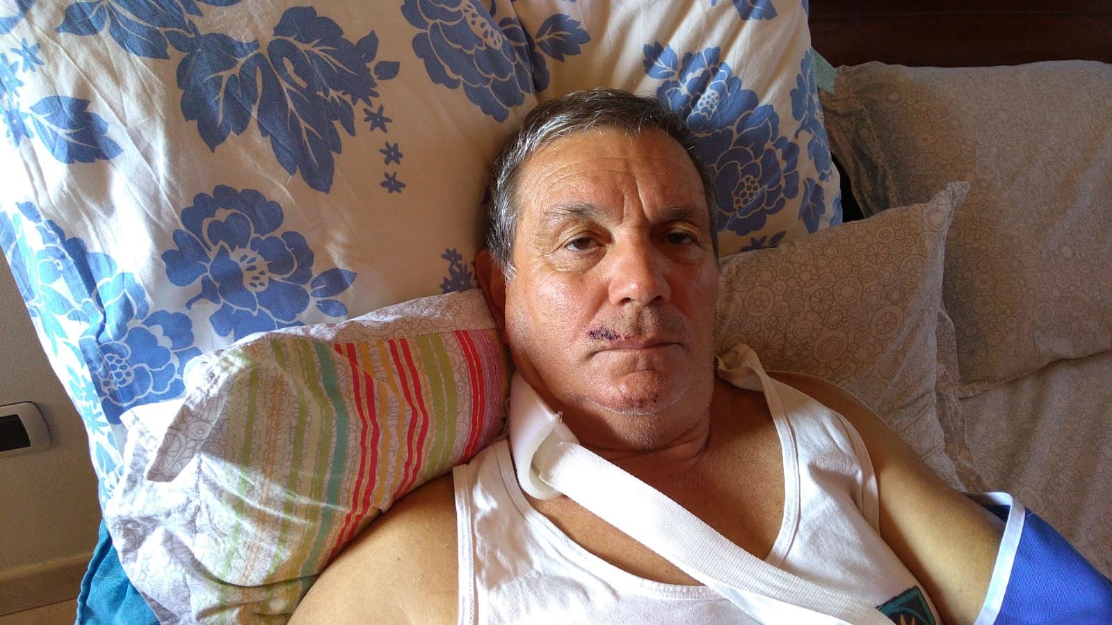 L’sos di Elio, forestale sardo: “Aiutatemi a trovare il pirata della strada che mi ha investito a Serri”