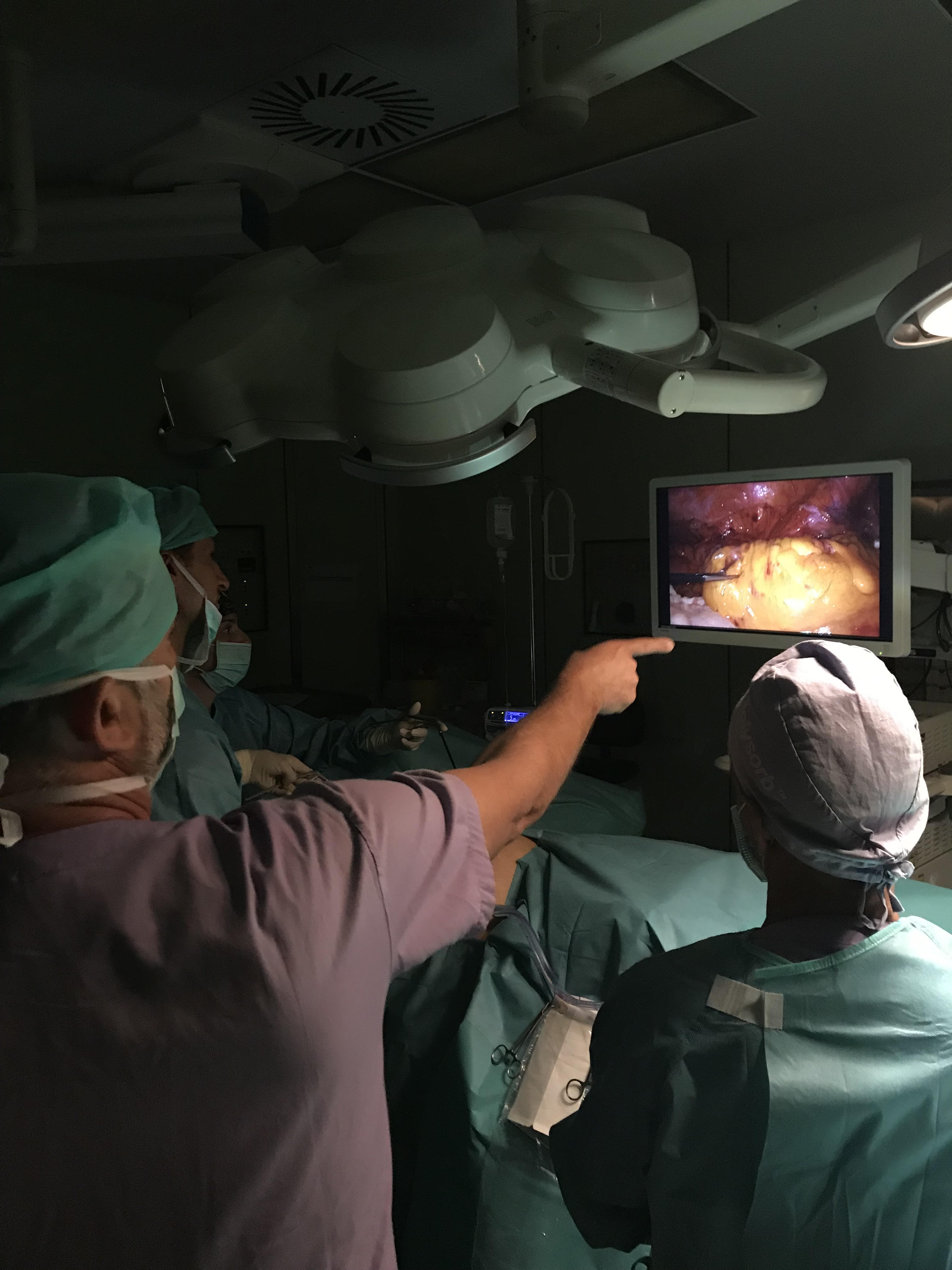 Lotta al tumore del colon retto, Policlinico Duilio Casula in prima linea: al via il percorso