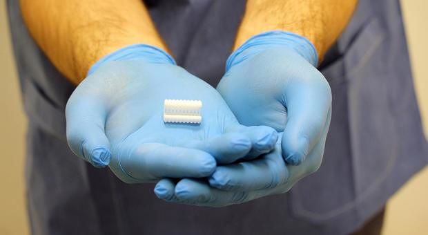  Un bambino di 5 anni torna a respirare da solo grazie a un bronco riassorbibile stampato in 3D