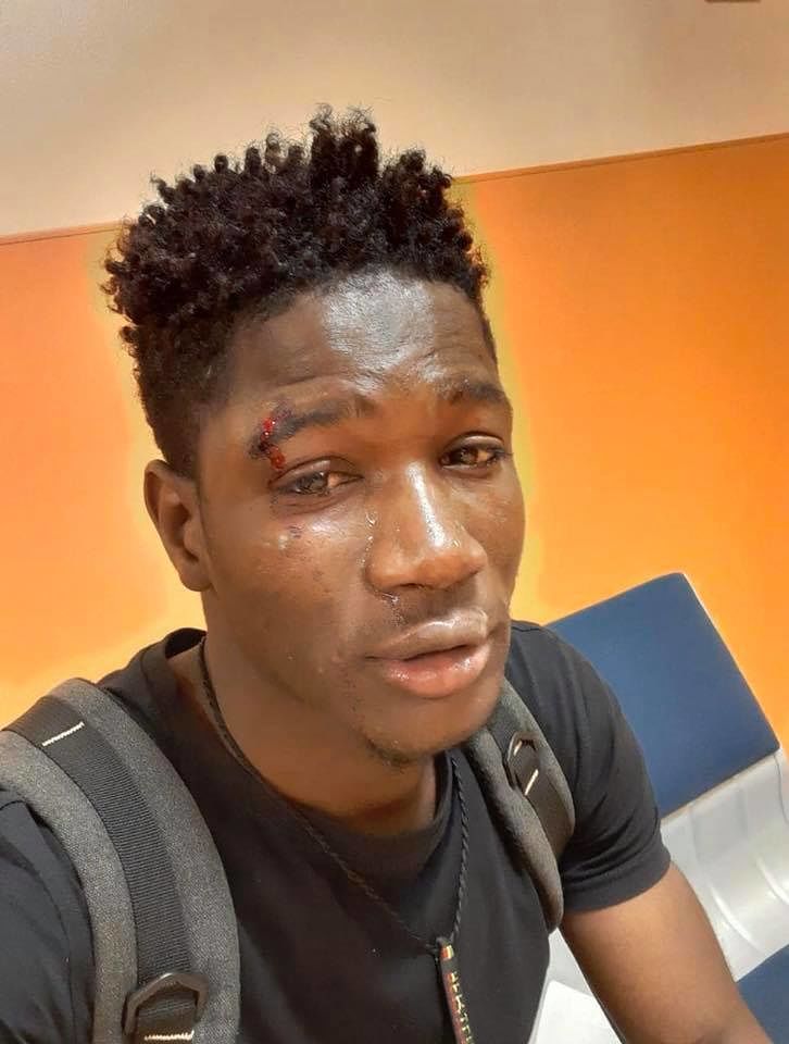 “Vattene via, negro di m…”, giovane senegalese accerchiato e pestato dal branco a Palermo