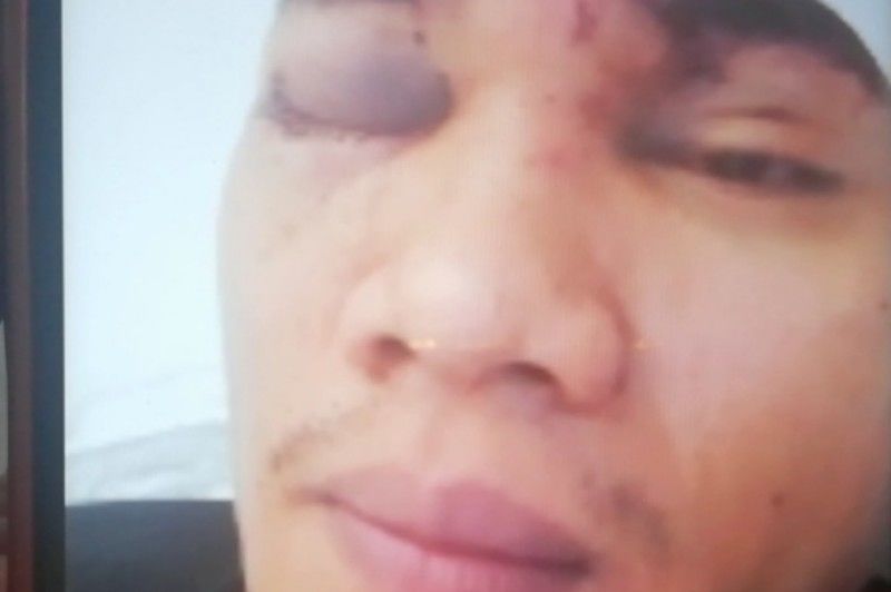 Cagliari, filippino pestato sul bus: “Mi hanno scambiato per un cinese”