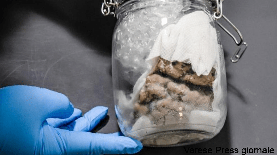 Usa, orrore alla dogana: trovato un barattolo con dentro un cervello umano