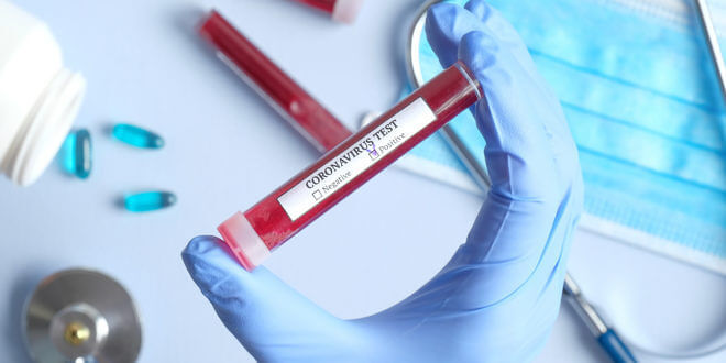 Coronavirus e imprenditori ko in Sardegna, appello alle banche: “Stop alla riscossione delle rate”