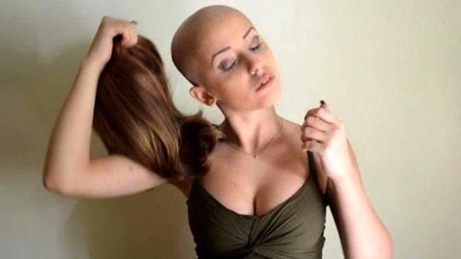 Pazienti oncologiche sarde, la bella notizia: la Regione pagherà le parrucche per le donne col tumore