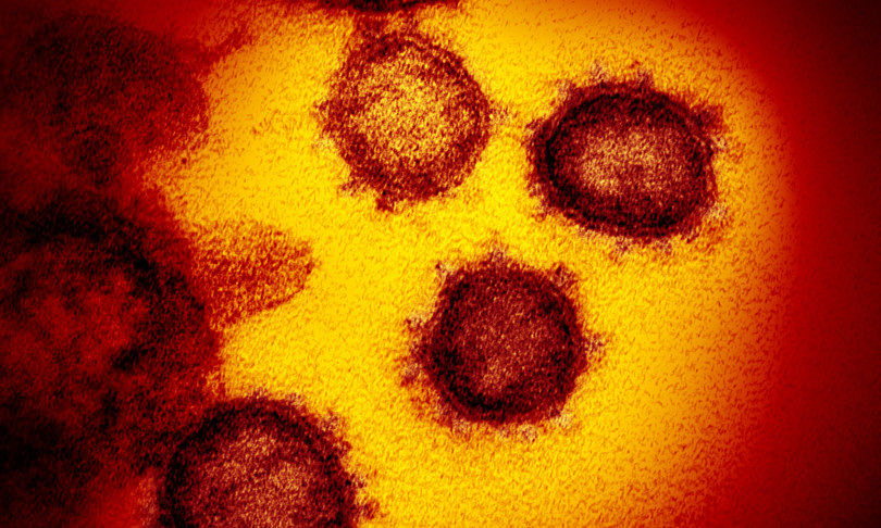 Il Coronavirus “sfuggito” dai laboratori di Wuhan? E’ polemica fra Usa e Cina