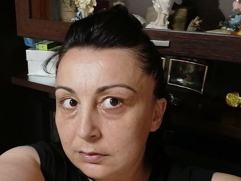 “Hanno estratto 23 denti a mio marito a Quartu, poi hanno chiuso: mastica con le gengive”