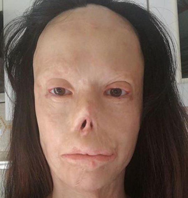 Valentina Pitzalis: “La famiglia di chi mi ha ridotto così vuole riesumare il corpo di Manuel, vergogna”