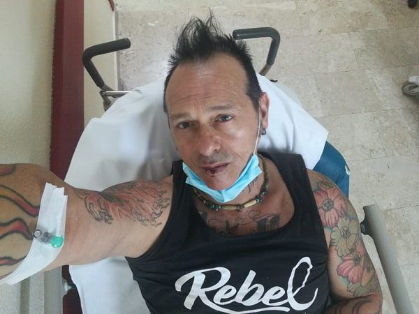 Walter Rebel: “Io, travolto fuori dalla mia officina in viale Elmas: gambe fratturate ma ho rischiato di morire”