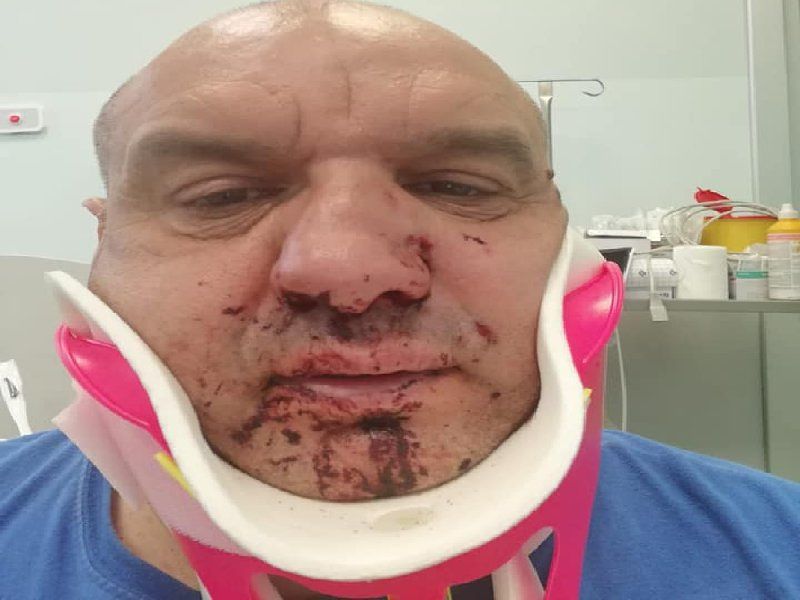 Follia in Sardegna, “autista di ambulanza pestato brutalmente durante un intervento”