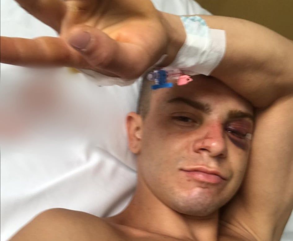 Emanuele, pestato in spiaggia a Gonnesa da dieci giovani: “Li ho denunciati tutti, mi hanno picchiato così”