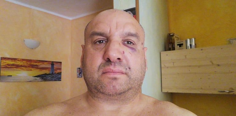 “Io, soccorritore sardo del 118 picchiato perchè l’ambulanza era in mezzo alla strada: sono choccato”