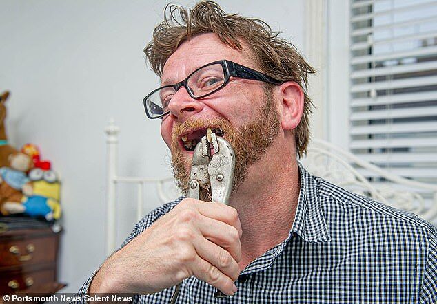 Ospedali pieni per il Coronavirus: inglese si ubriaca e si estrae due denti da solo