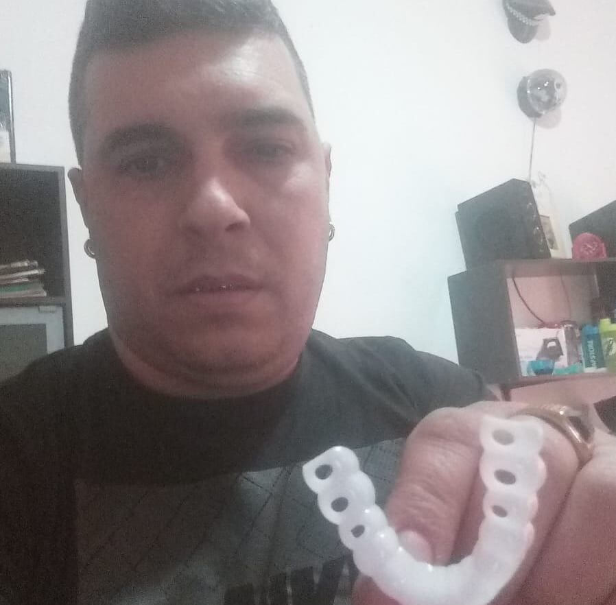 Cagliari, “75 euro buttati per fascette dentali online: non mi stanno, resterò con la protesi saltata”