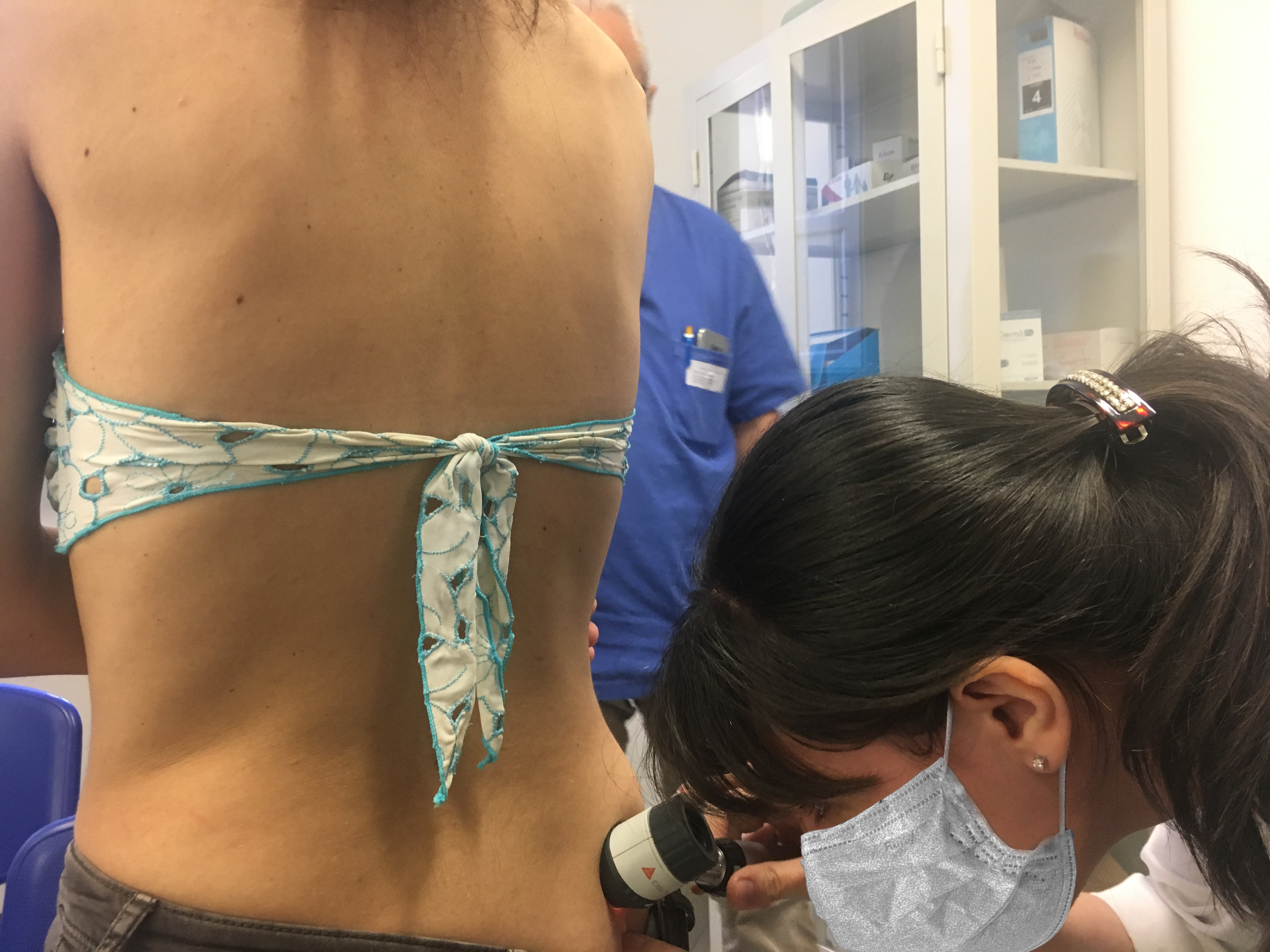 Tumori della pelle, arriva anche a Cagliari la campagna di sensibilizzazione: consulti gratuiti nella Dermatologia del San Giovanni di Dio