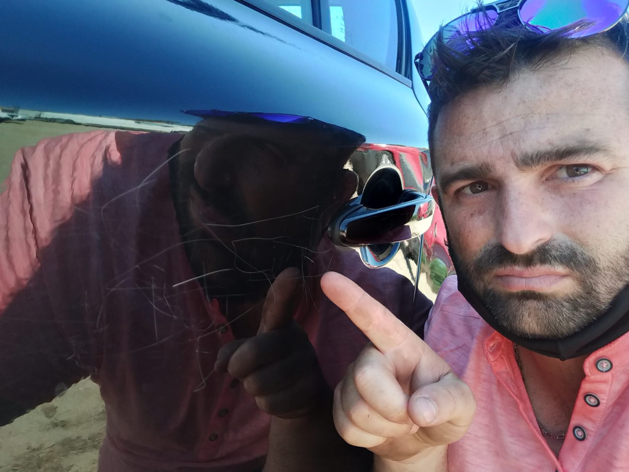 Cagliari, la denuncia: “Auto danneggiata al Brotzu dopo la lite con un parcheggiatore abusivo”