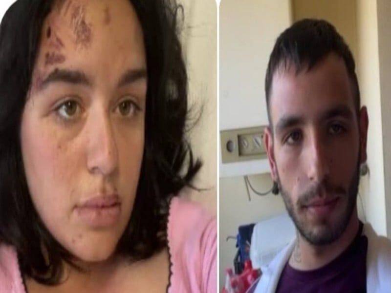 “Feriti e fratturati dopo che un’auto ci ha tagliato la strada in viale Marconi, cerchiamo testimoni”