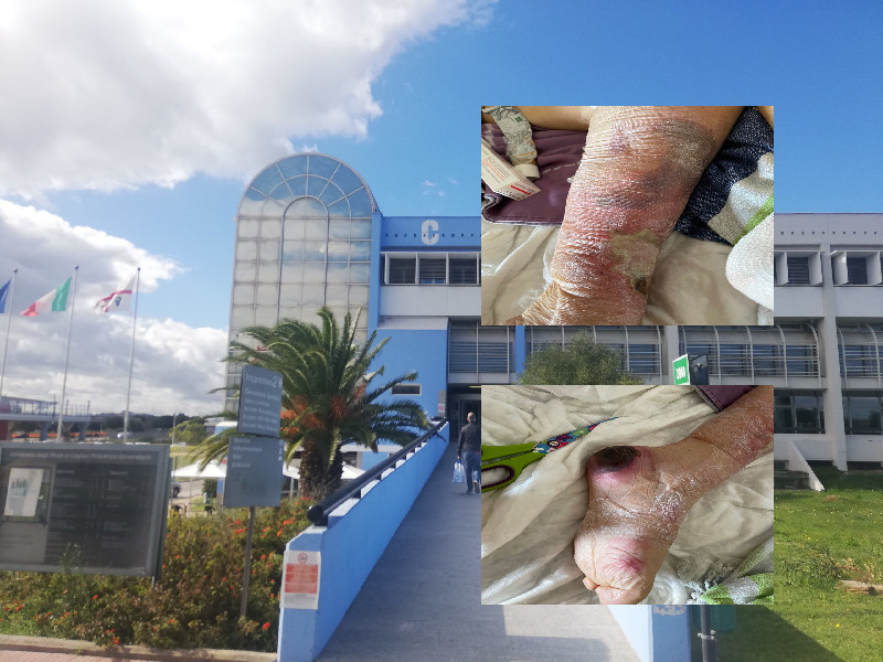 Cagliari, “mia mamma piena di piaghe dimessa e morta dopo il nuovo ricovero al Policlinico di Monserrato”