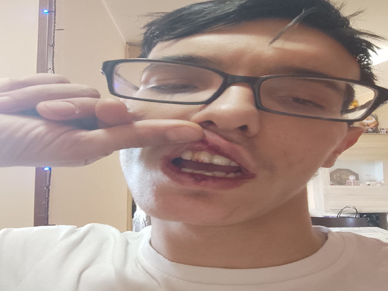 “Aggredito e rapinato da due stranieri armati a Selargius, mi hanno anche preso a pugni”