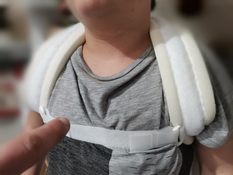 Choc a Quartu: “Mio figlio 13enne bullizzato a Pitz’e Serra da un coetaneo, ha clavicola e spalla fratturate”