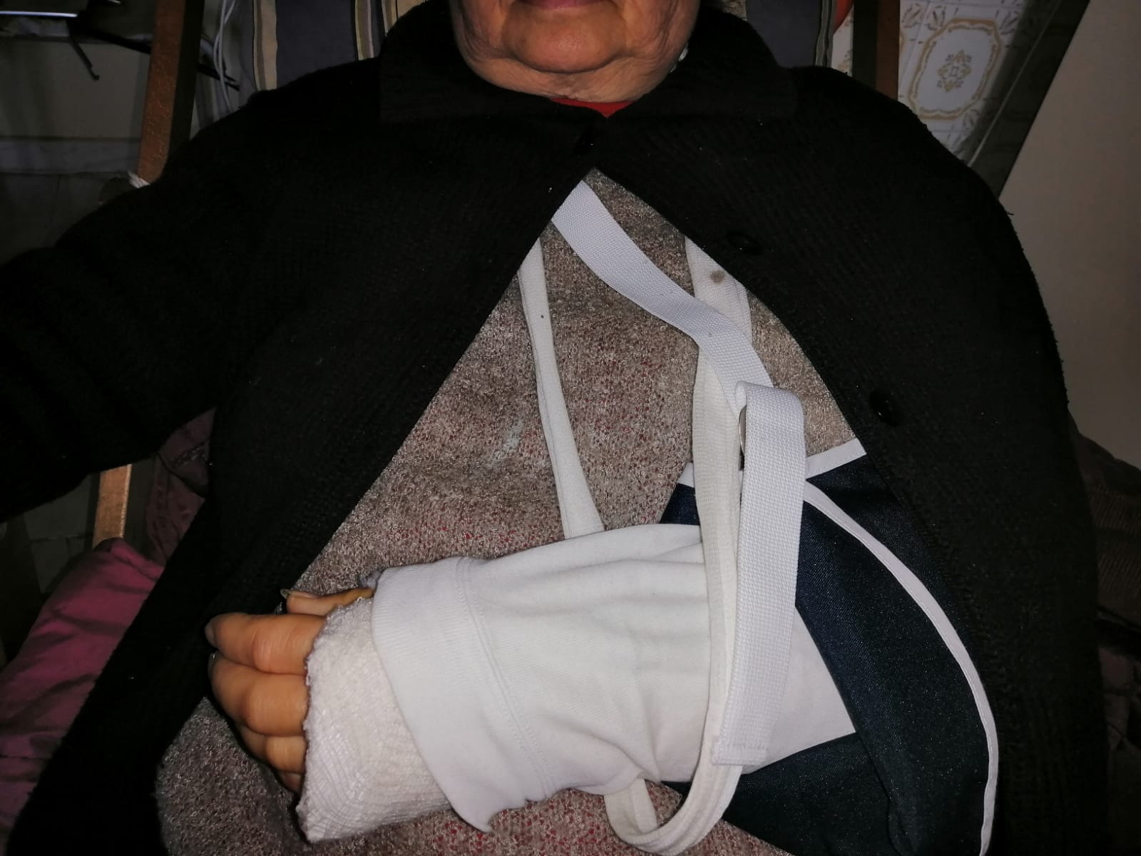 “Caduta e fratturata per colpa del marciapiede a Pirri, voglio essere risarcita e cerco chi mi ha soccorsa”