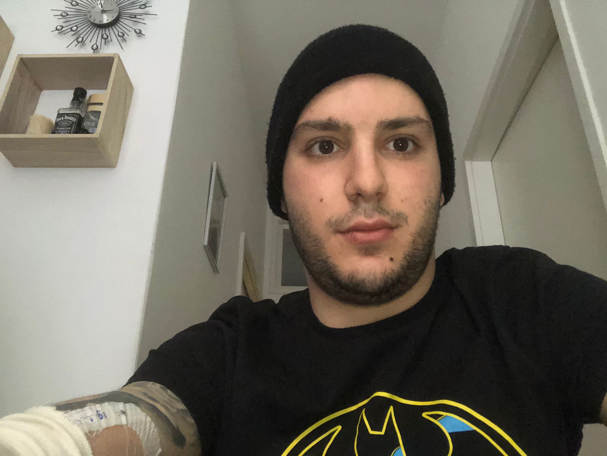 La battaglia per la vita di Michele, monserratino in Olanda: “Ho il linfoma di Hodgkin, aiutatemi”